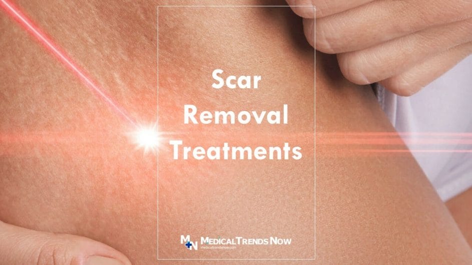 Scar Removal in Philippines • Check Prices & Reviews