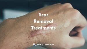 Getting rid of old scars: Best home remedies