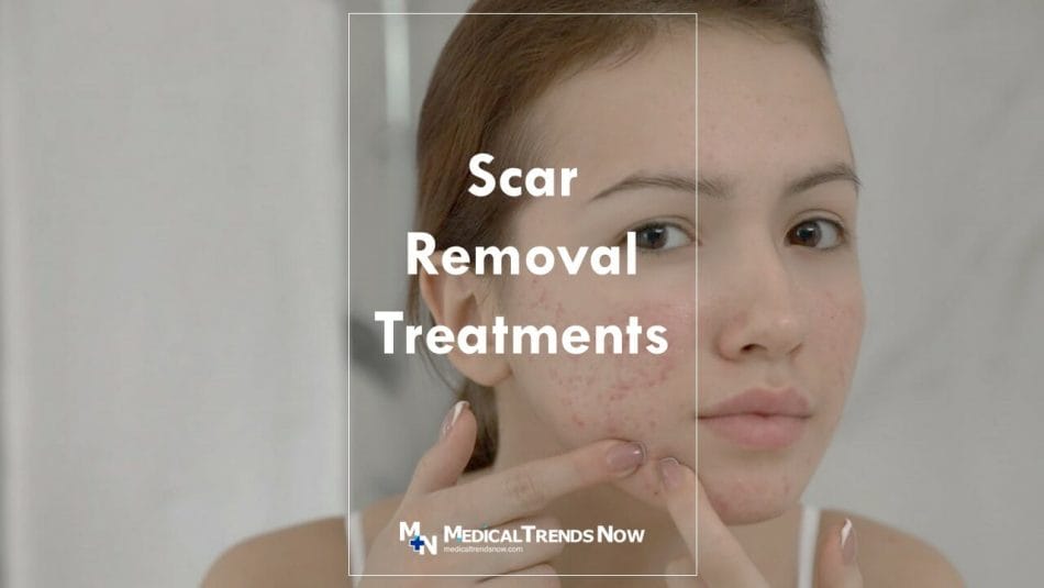 How to Make Scars Less Visible