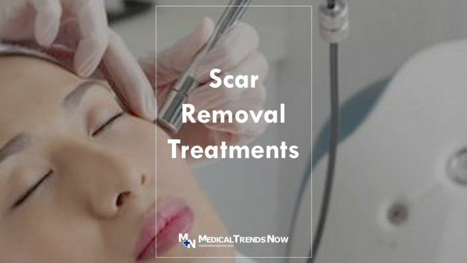 Scar and Keloid Removal 