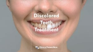 causes of discolored tooth and possible treatments