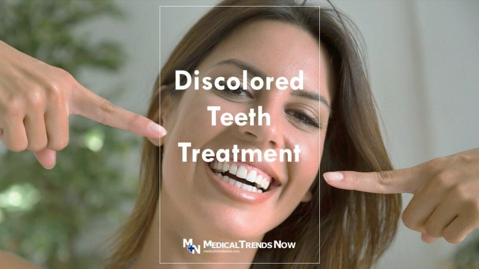 causes of discolored tooth and possible treatments