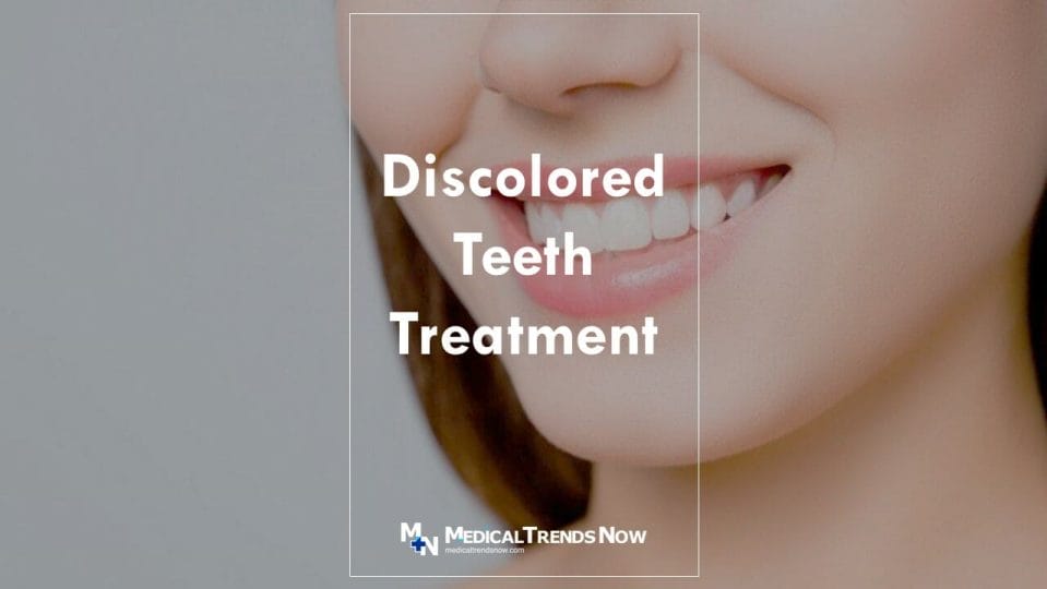 causes of discolored tooth and possible treatments 