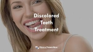 causes of discolored tooth and possible treatments