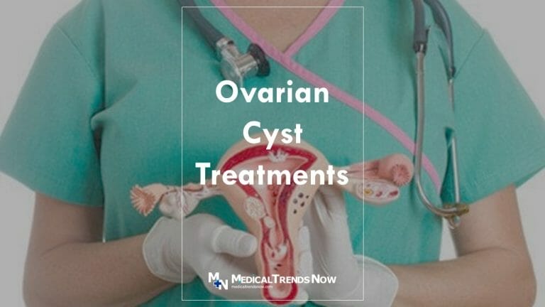 Treatments for Ovarian Cysts in the Philippines – Medical Trends Now