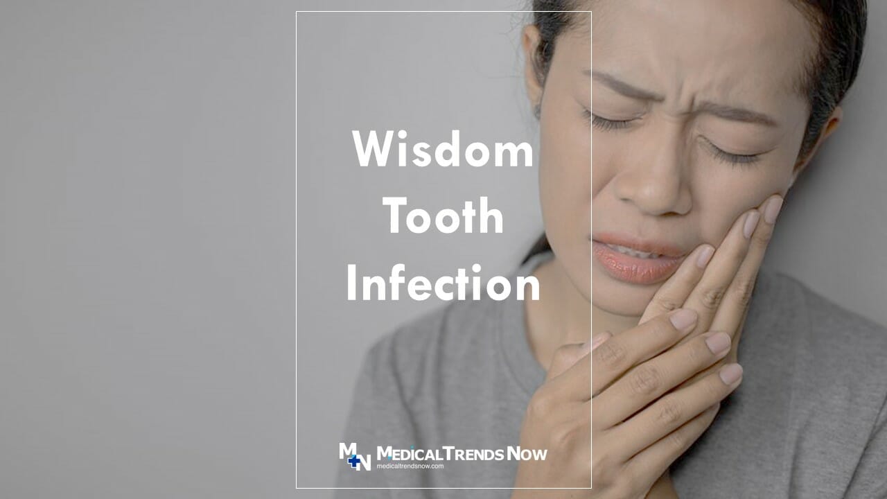 What Causes a Wisdom Tooth Infection and How To Treat Pericoronitis ...