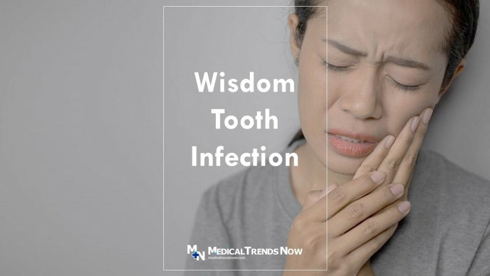 How Do You Treat Pericoronitis? Toothache