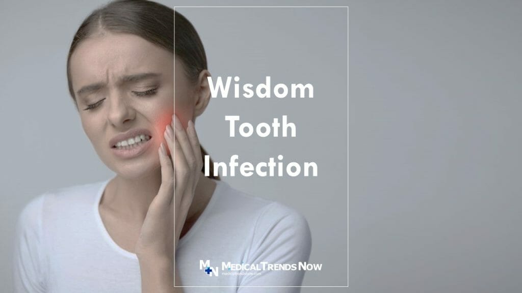 What Causes a Wisdom Tooth Infection and How To Treat Pericoronitis?