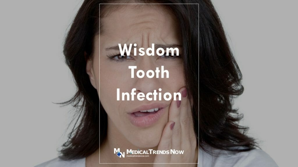 What Causes a Wisdom Tooth Infection and How To Treat Pericoronitis?