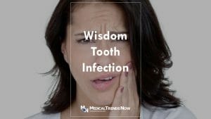 How Do You Treat Pericoronitis