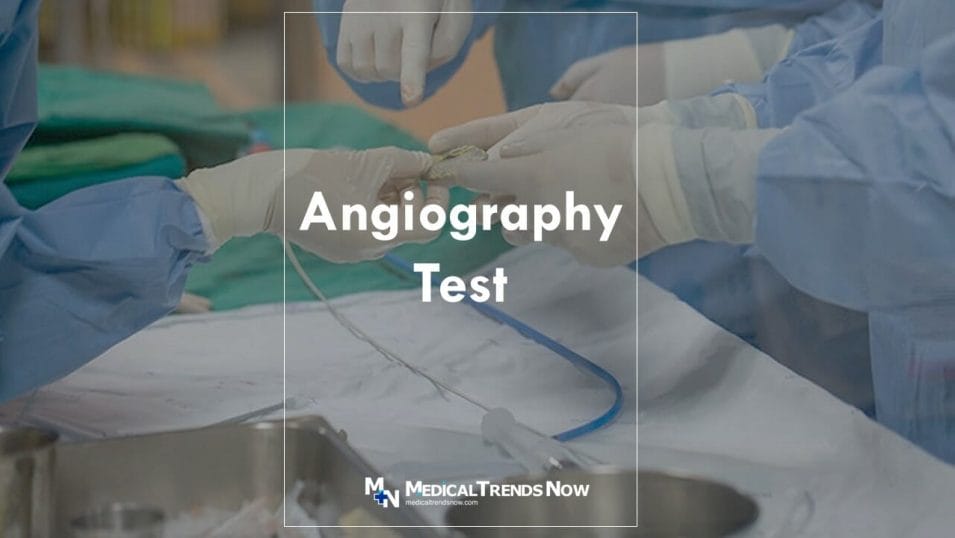 Angiogram: Procedure Details, Risks & Recovery