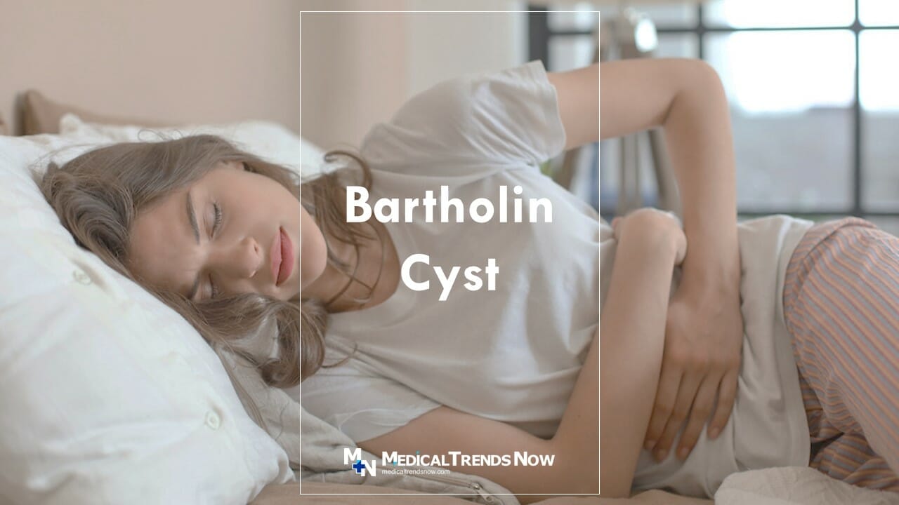 What Is a Bartholin Cyst and How Is It Different From a Cyst? - Medical ...