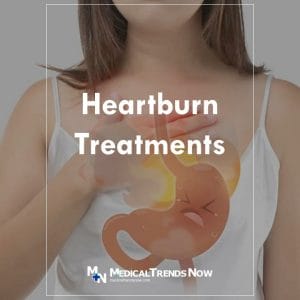 Treatments for Heartburn in the Philippines: Get Rid of Acid Reflux