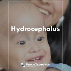 What Is Hydrocephalus? What Causes It and Is it Life Threatening?