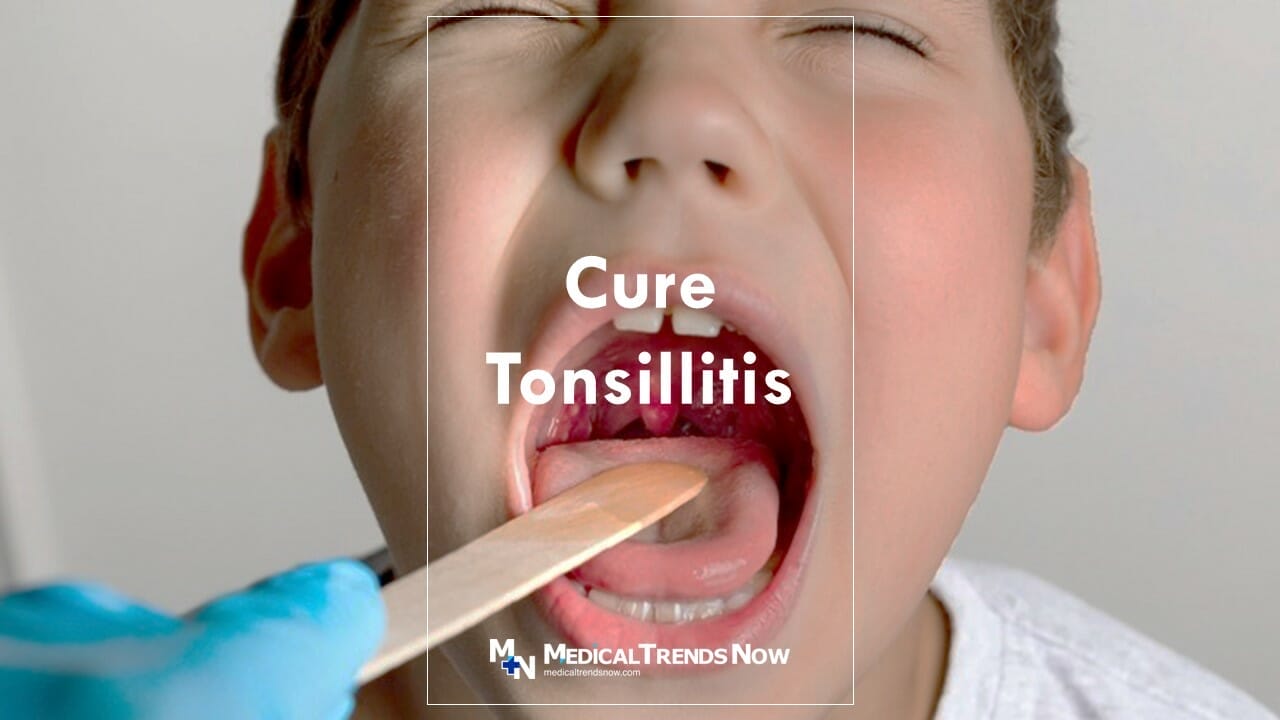 treatment for Tonsillitis for kids