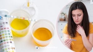 Pregnancy Test, Urine Color can detect early pregnancy