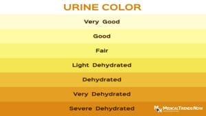 urine color health check